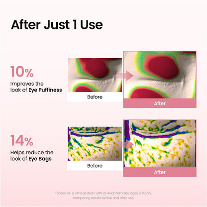 Hydrogel Eye Patches for under Eye - Collagen Peptide, anti Wrinkle & Fine Lines (60 Count)